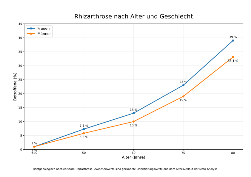 Rhiz4